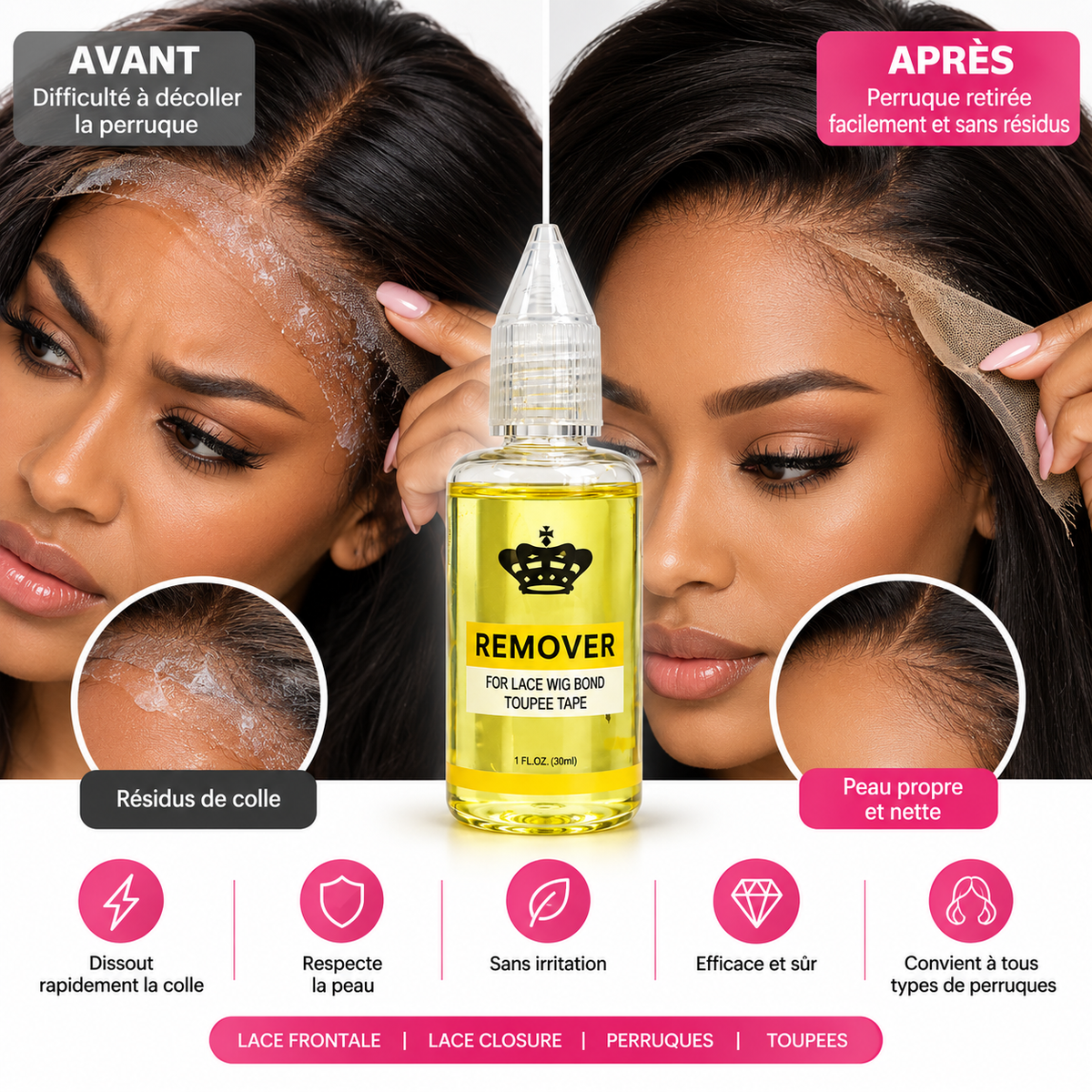 Dissolvant Colle Perruque & Lace – Remover 30 ml